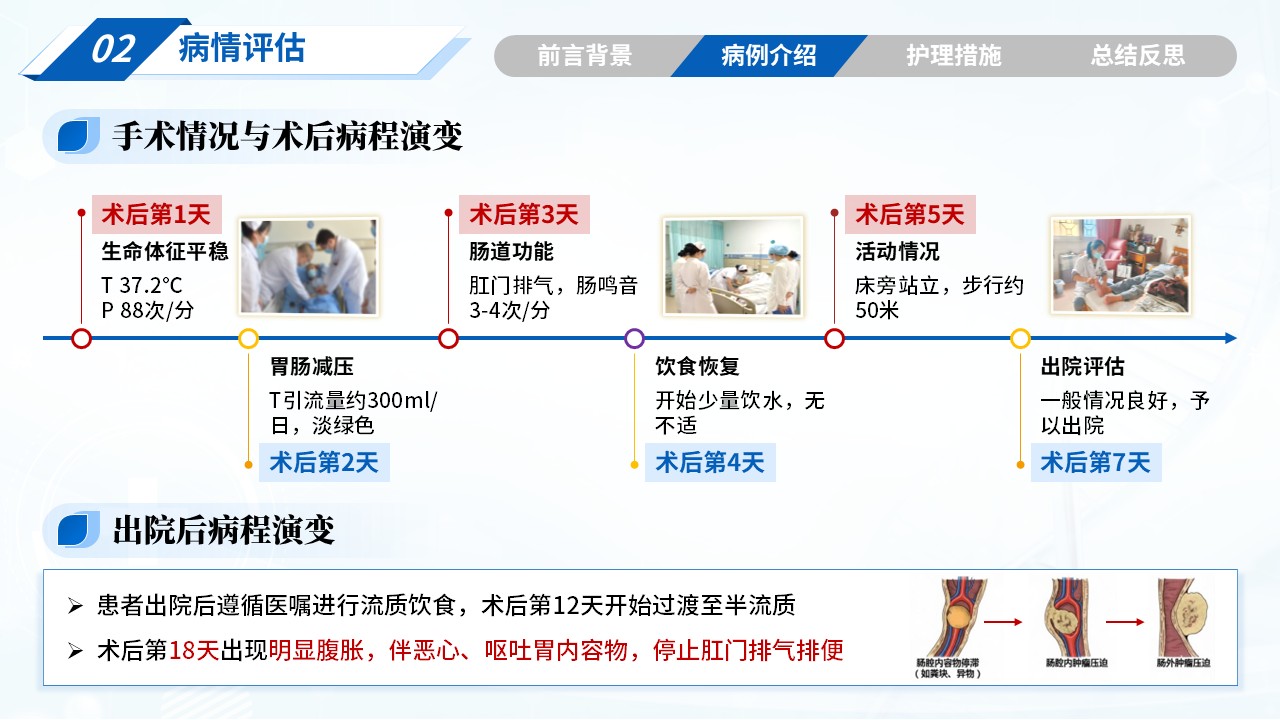 314期-疑难病例-1例胃癌术后并发肠梗阻患者的护理措施第6页预览