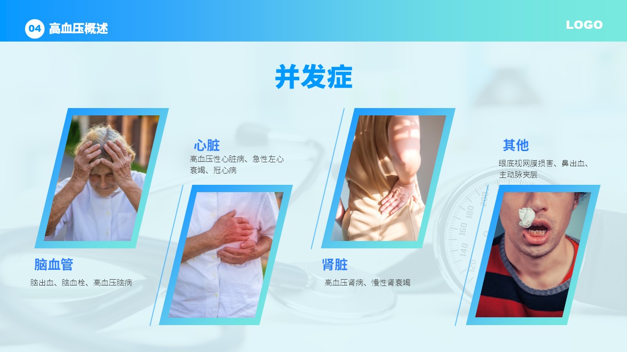 37-高血压护理查房第16页预览