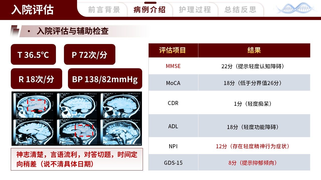 461期-护理个案-一例阿尔茨海默病早期患者的护理个案第9页预览
