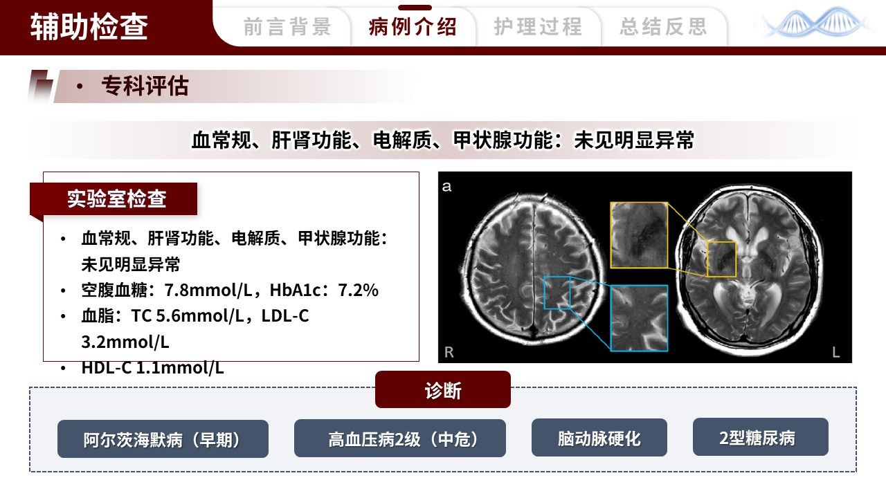 461期-护理个案-一例阿尔茨海默病早期患者的护理个案第10页预览