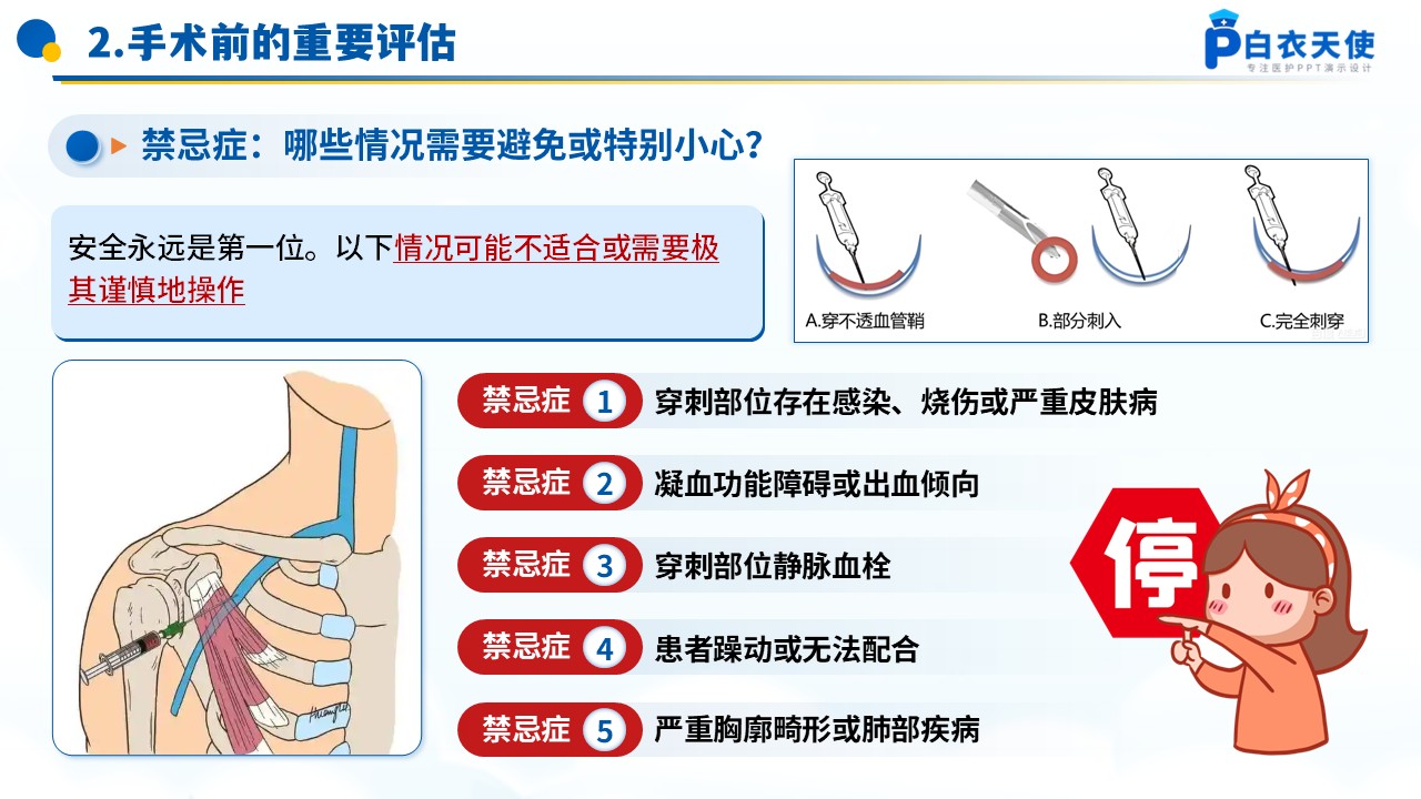 74-深静脉穿刺术健康宣教第6页预览
