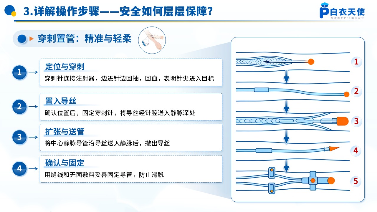 74-深静脉穿刺术健康宣教第9页预览