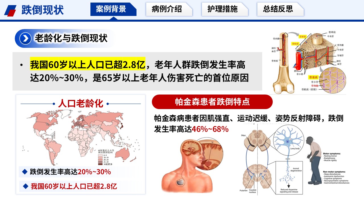 395期-护理个案-一例痴呆合并帕金森跌倒高危循证防护护理个案第3页预览