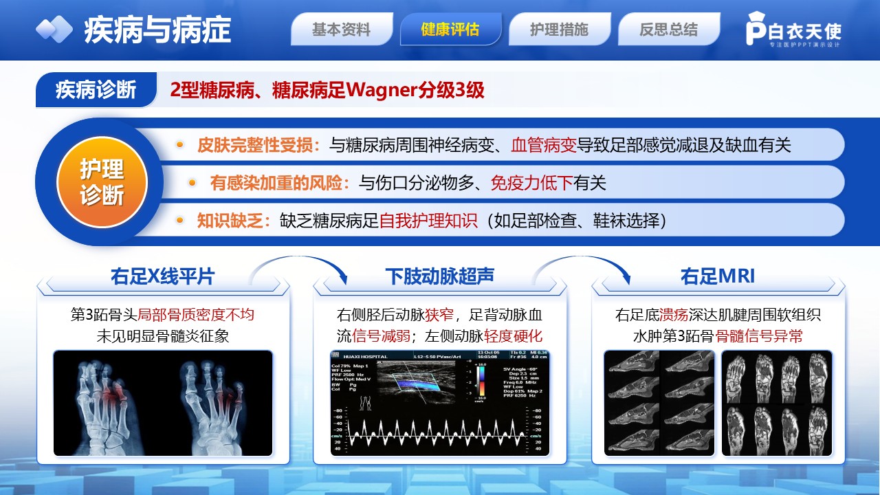 228期-护理个案-糖尿病足第6页预览