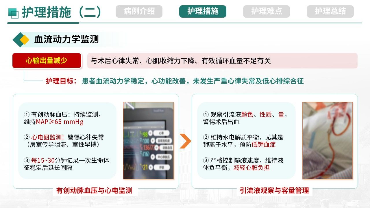 492期-疑难病例-一例感染性心内膜炎主动脉瓣毁损诊治第9页预览