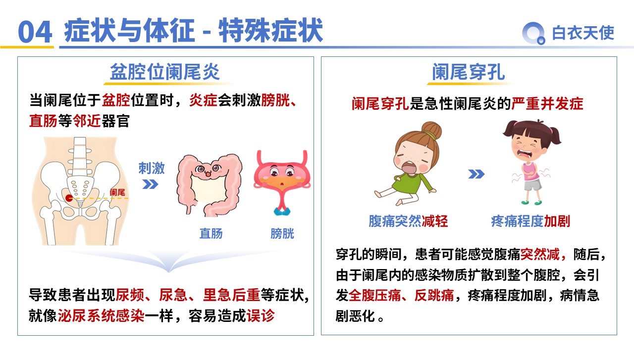 33-急性阑尾炎教宣第6页预览