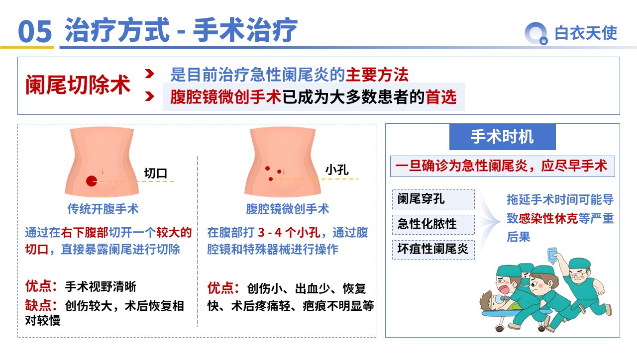 33-急性阑尾炎教宣第7页预览