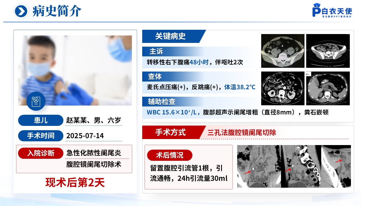 150期-循证教学查房（急性阑尾炎患儿的术后护理）第5页预览