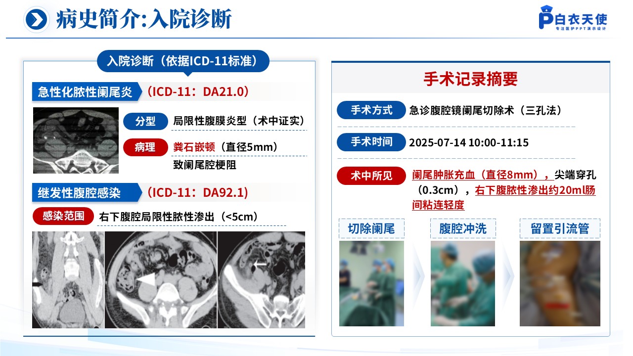150期-循证教学查房（急性阑尾炎患儿的术后护理）第6页预览