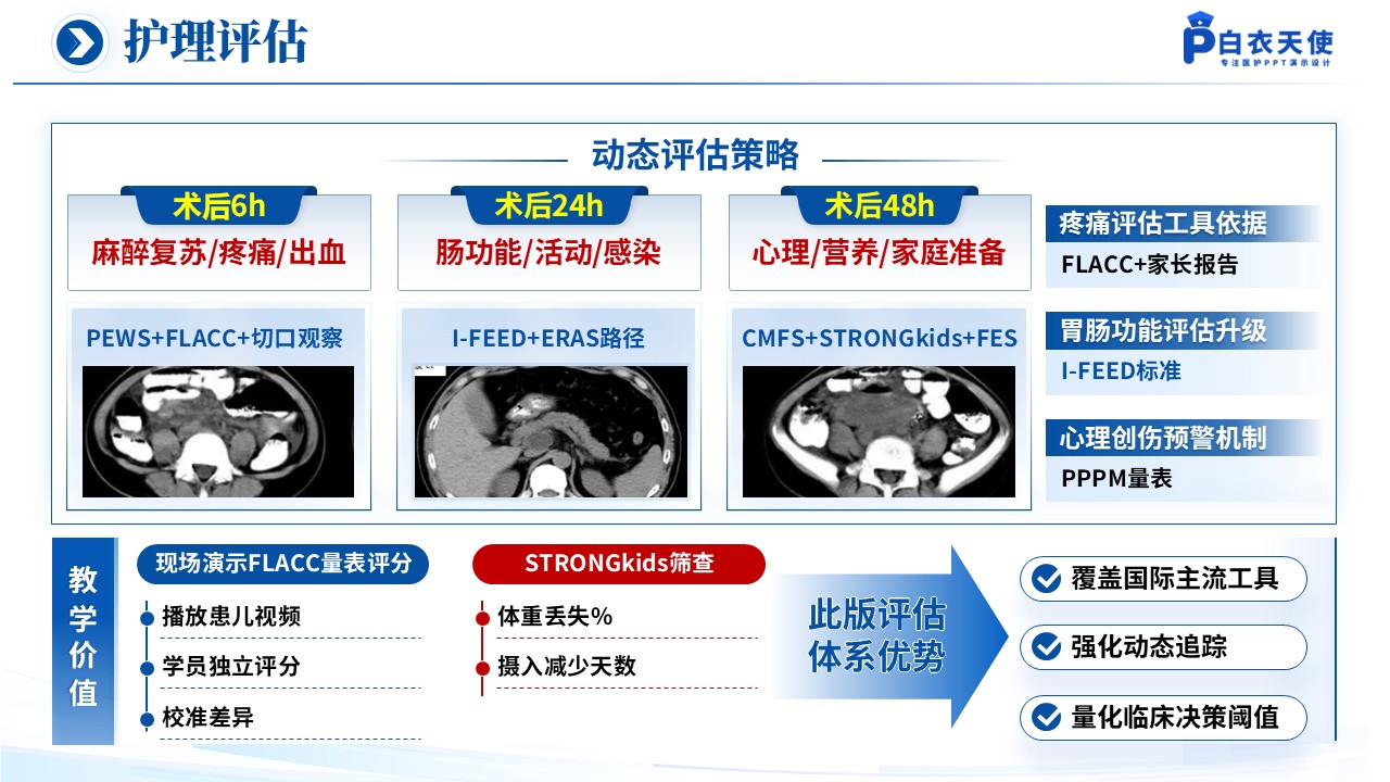 150期-循证教学查房（急性阑尾炎患儿的术后护理）第7页预览