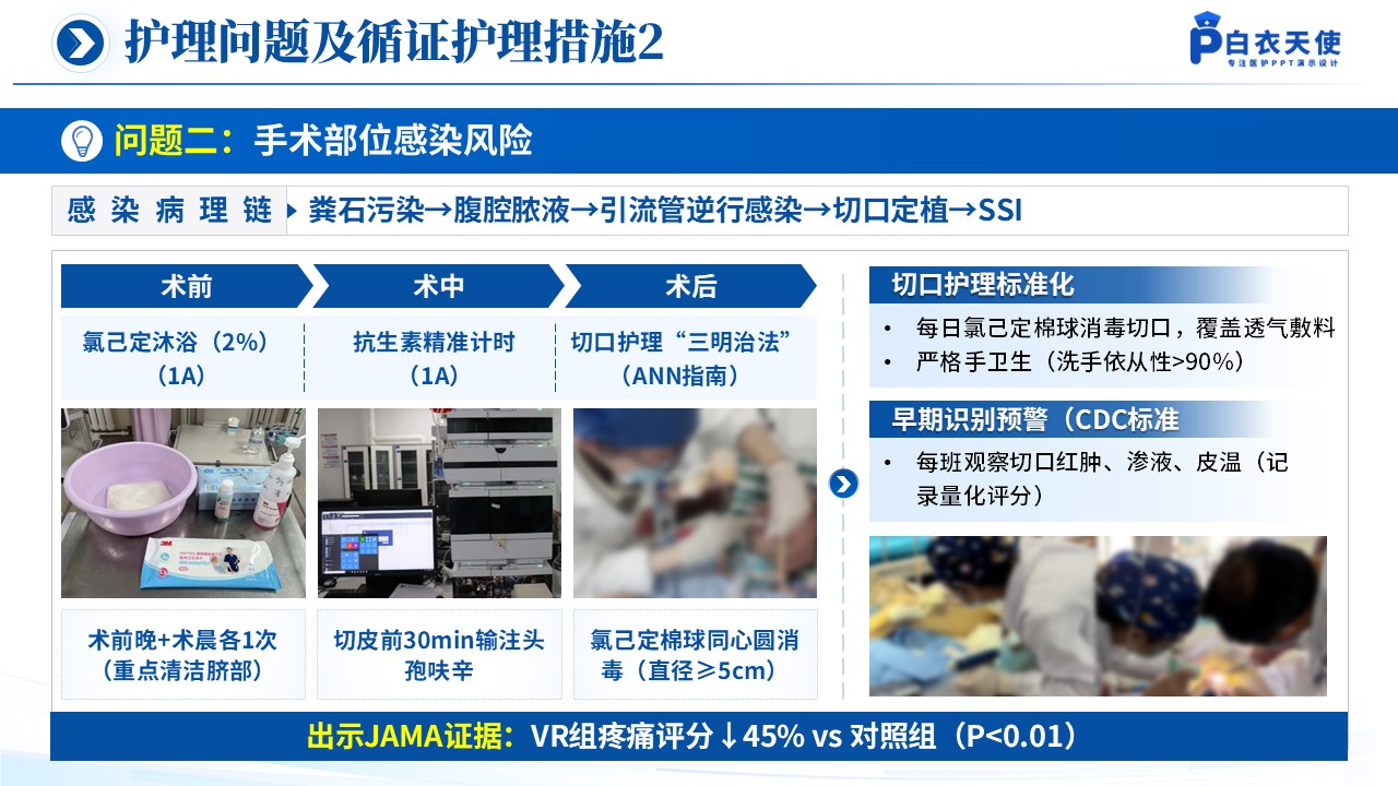 150期-循证教学查房（急性阑尾炎患儿的术后护理）第10页预览