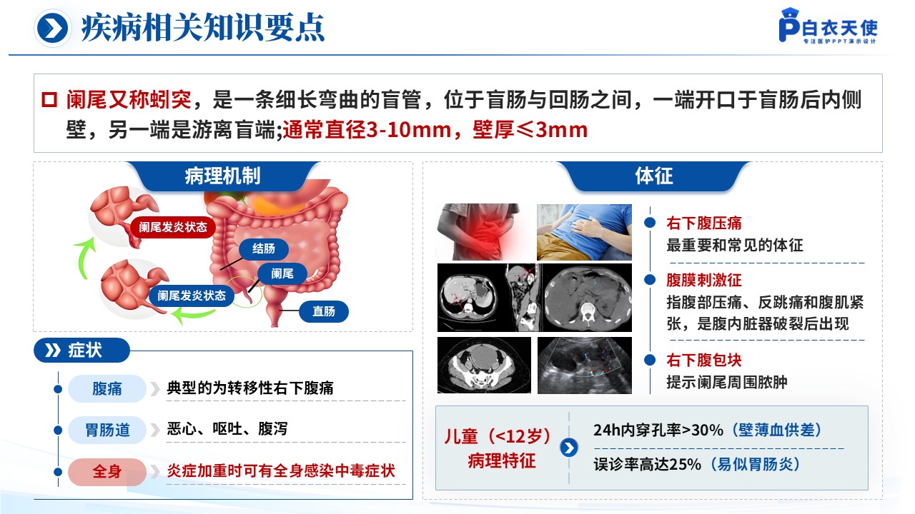 150期-循证教学查房（急性阑尾炎患儿的术后护理）第13页预览