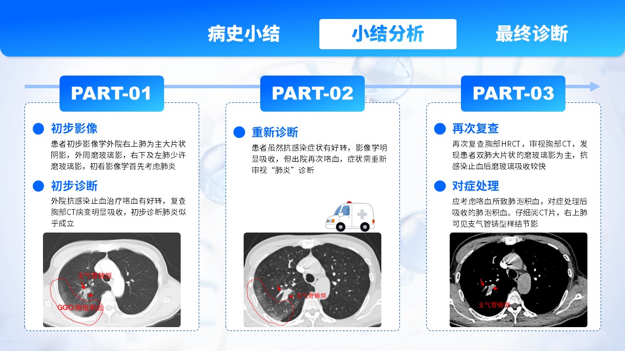 22-肺部感染护理个案第10页预览