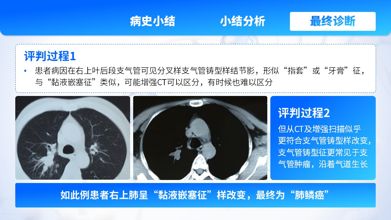 22-肺部感染护理个案第11页预览