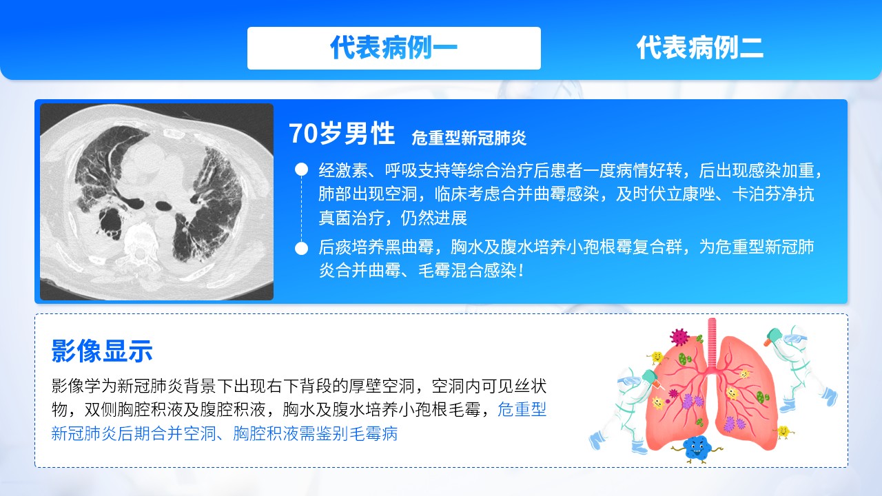 22-肺部感染护理个案第14页预览