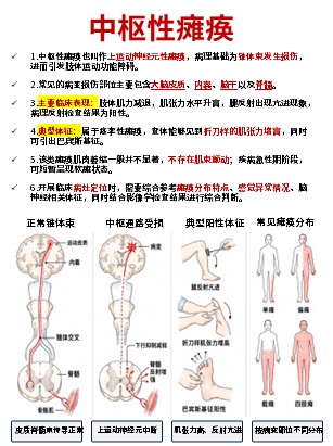 456期-科普文档-护理知识合集第4页预览