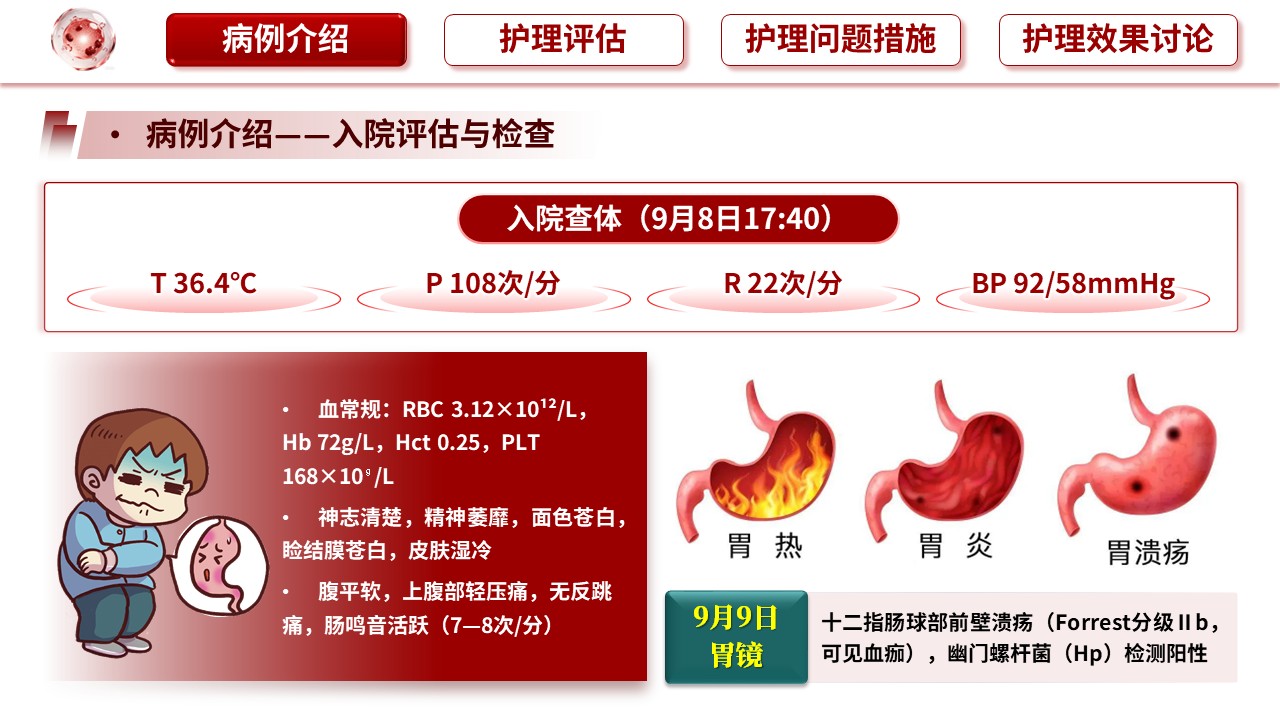 475期-护理查房-一例急性上消化道出血患者的护理查房第6页预览