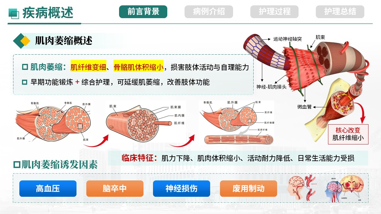 474期-护理个案-一例肌肉萎缩患者综合护理实践第3页预览