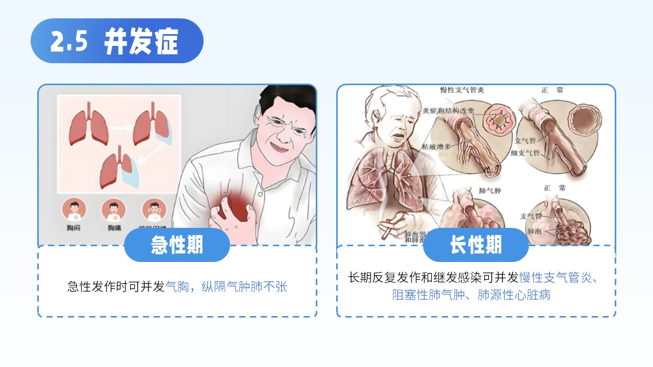 12-支气管哮喘的护理查房第10页预览