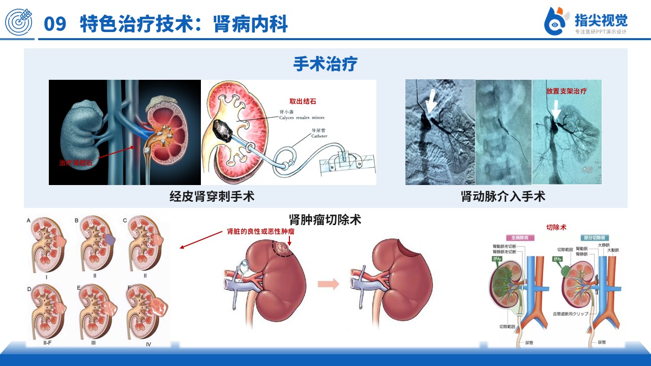 121期-主任竞聘医疗特色（蓝色）第9页预览