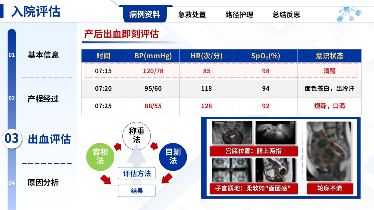 331期-护理个案-产后出血急救流程结合临床路径护理实践第5页预览