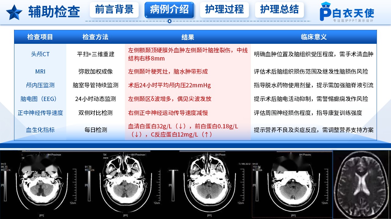 218期-护理个案-一例创伤性颅脑损伤患者的神经功能恢复护理第6页预览