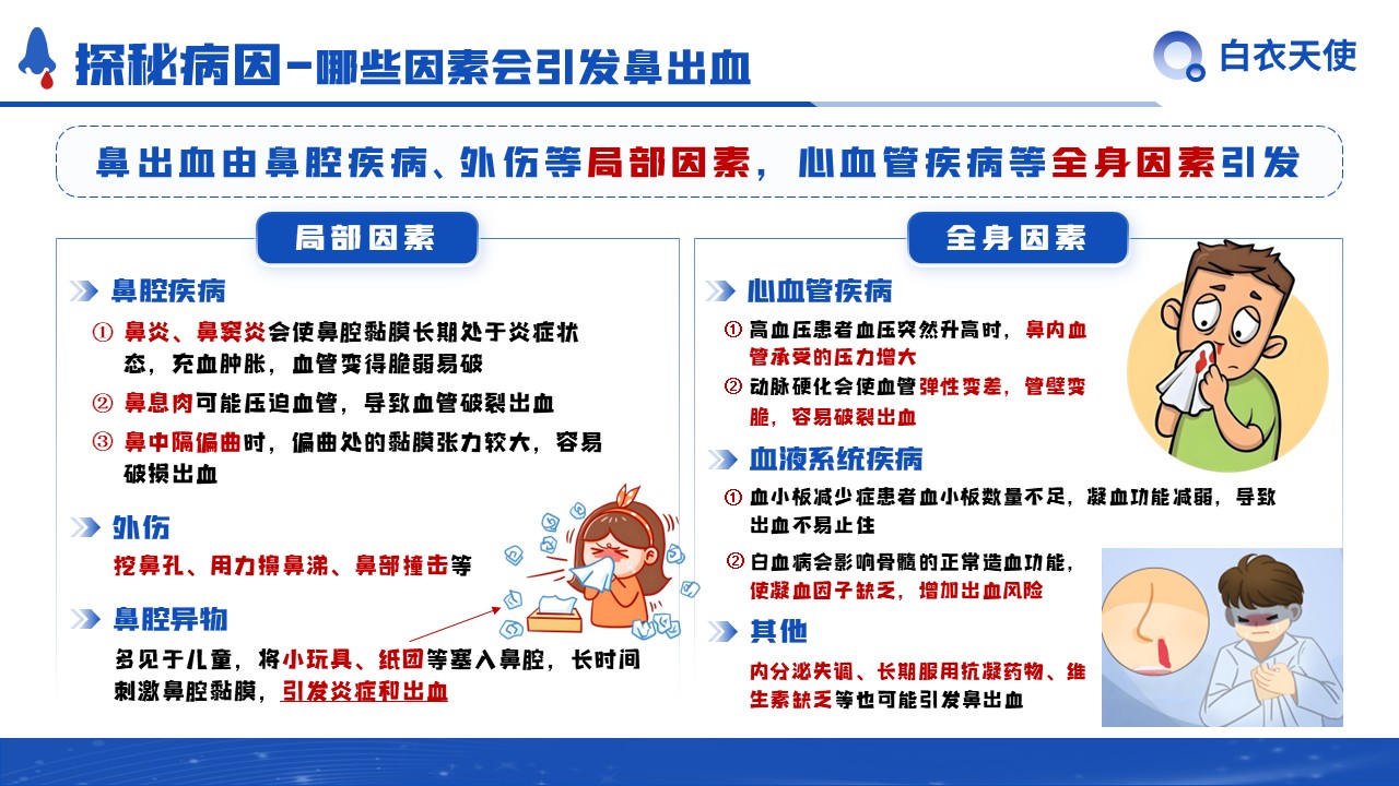 29-鼻出血健康宣教第4页预览