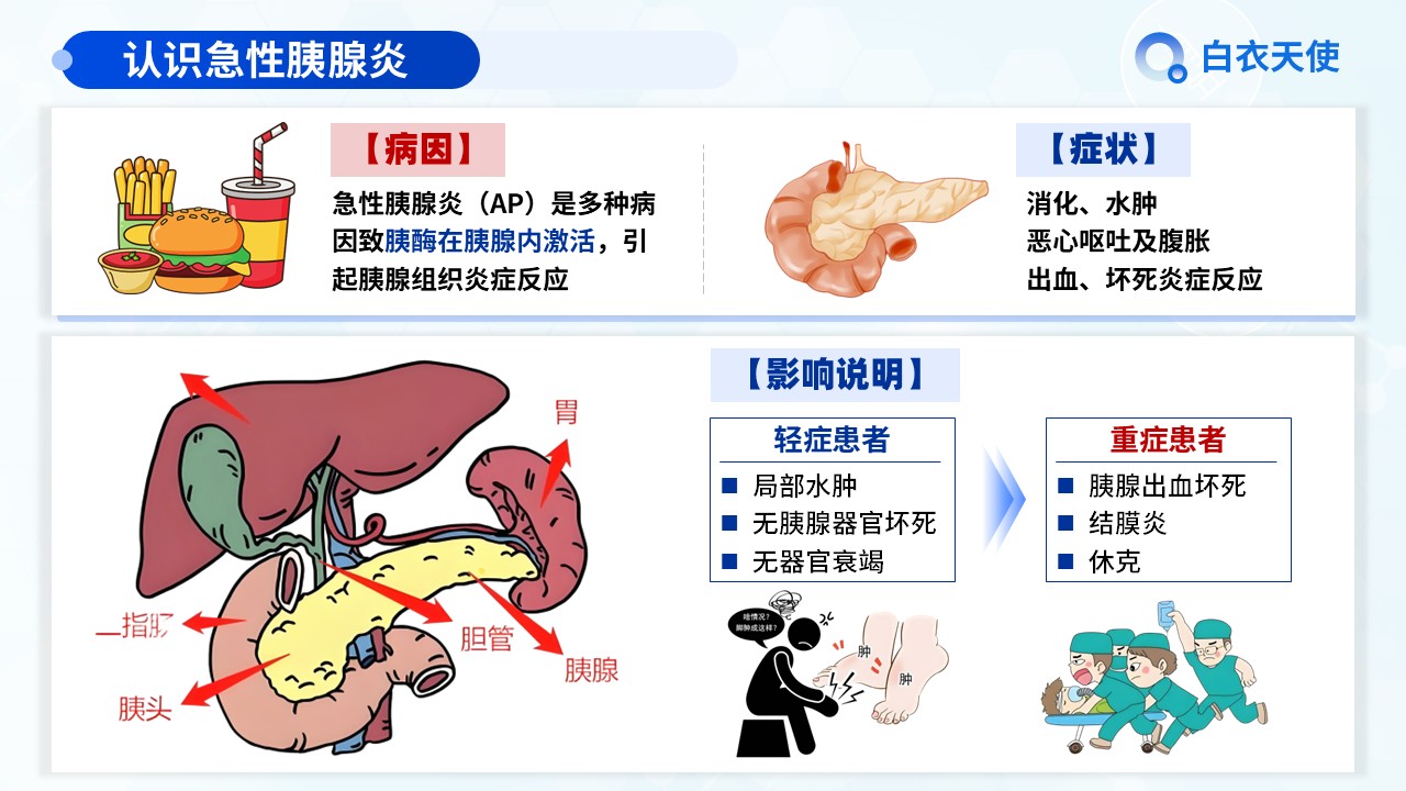18-急性胰腺炎健康宣教第3页预览