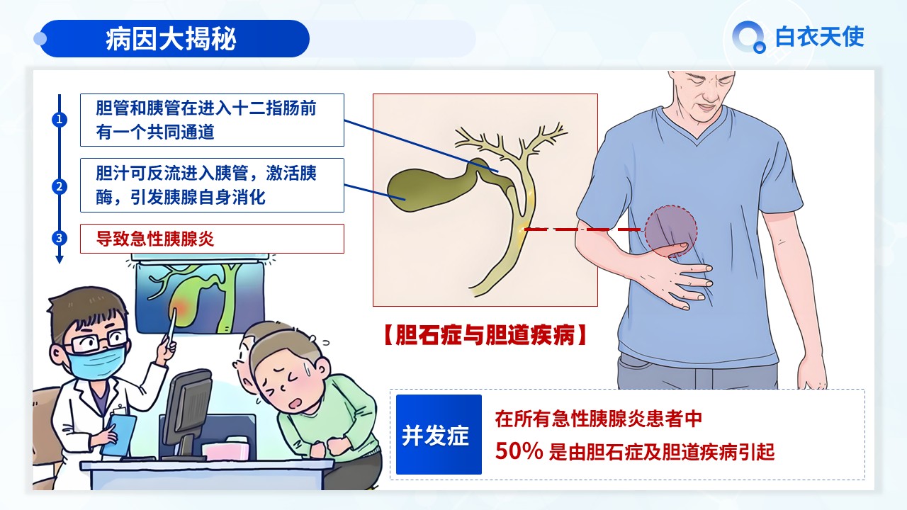 18-急性胰腺炎健康宣教第4页预览