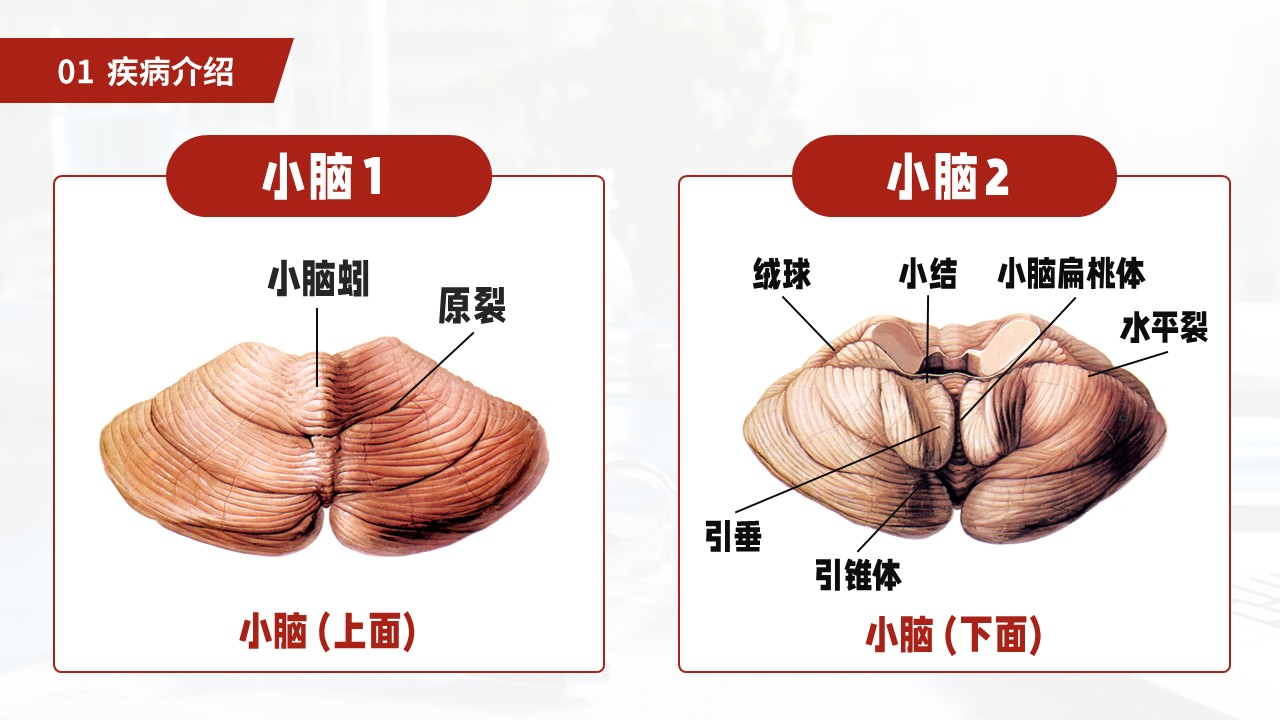 27-小脑扁桃体下疝畸形护理常规第8页预览