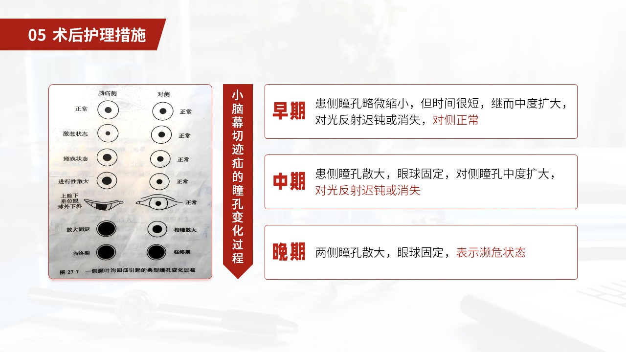 27-小脑扁桃体下疝畸形护理常规第36页预览