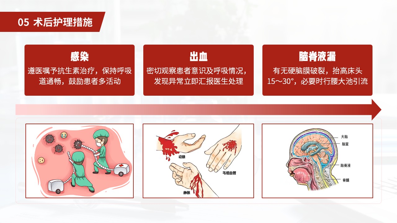 27-小脑扁桃体下疝畸形护理常规第37页预览