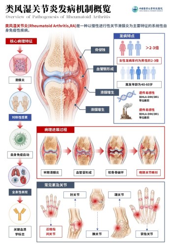 2期-科研绘图-内风湿关节炎发病机制图