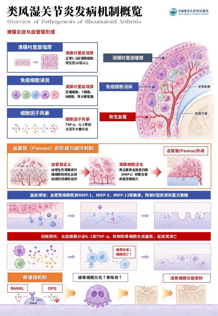 2期-科研绘图-内风湿关节炎发病机制图第4页预览