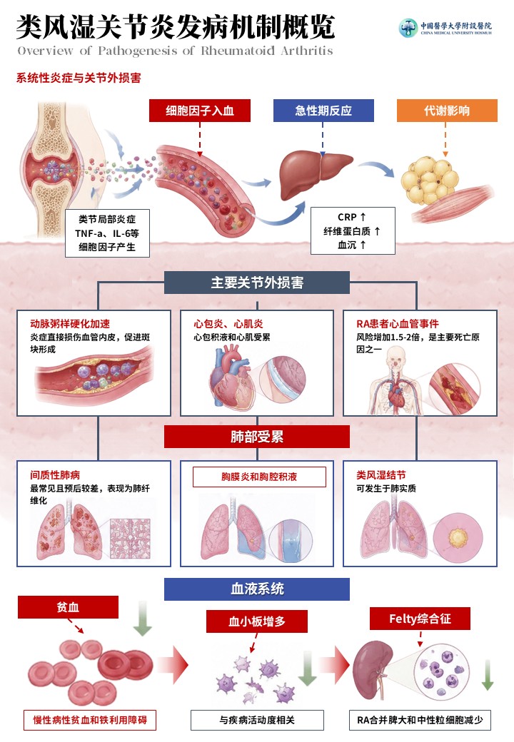 2期-科研绘图-内风湿关节炎发病机制图第5页预览