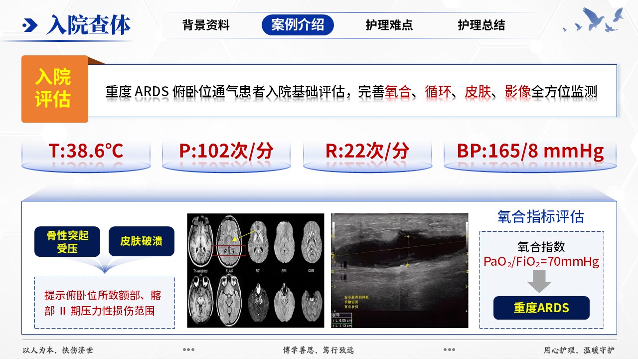 417期-疑难病例-一例中重度 ARDS 俯卧位通气并发压力损伤患者护理第7页预览
