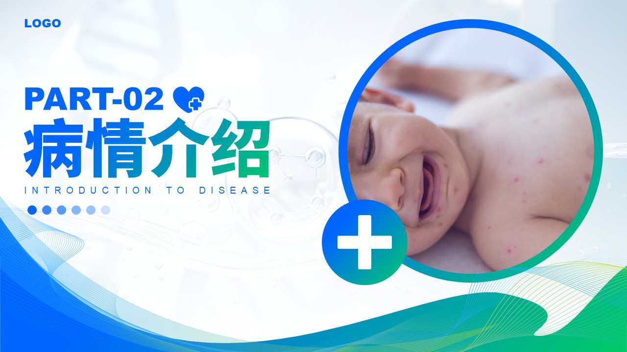 75-水痘护理查房第6页预览