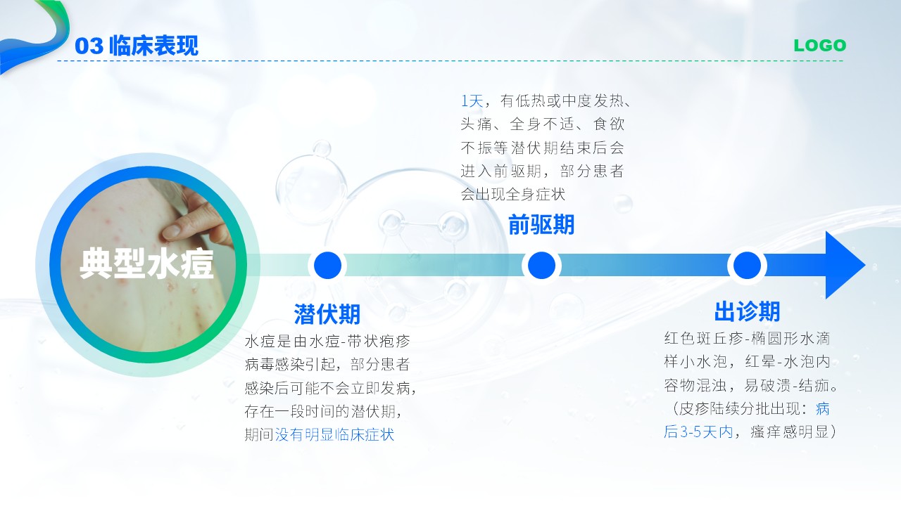 75-水痘护理查房第10页预览