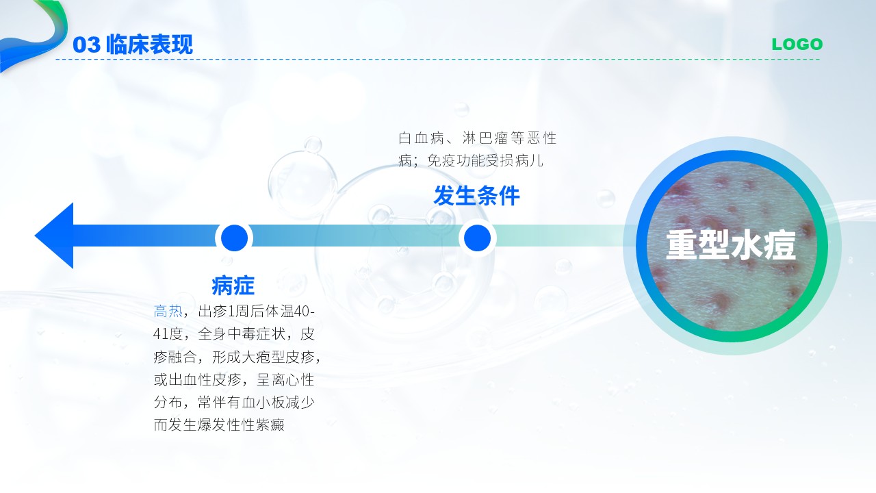 75-水痘护理查房第11页预览