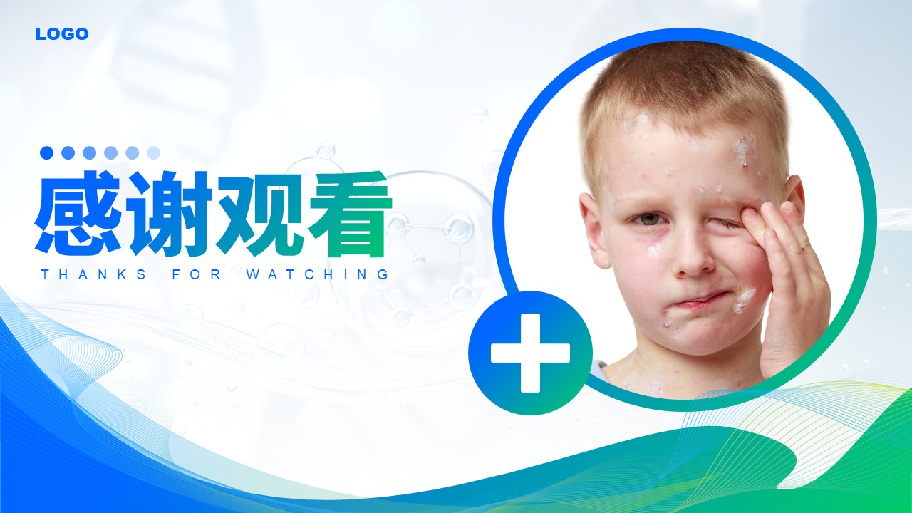 75-水痘护理查房第20页预览