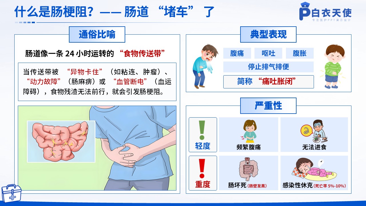 38-肠梗阻健康宣教第3页预览