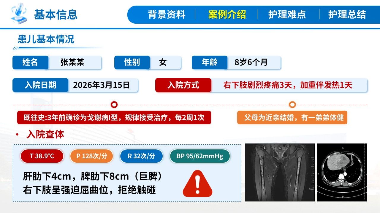 404期-疑难病例讨论-一例戈谢病合并骨危重症患儿的疑难病例讨论第6页预览