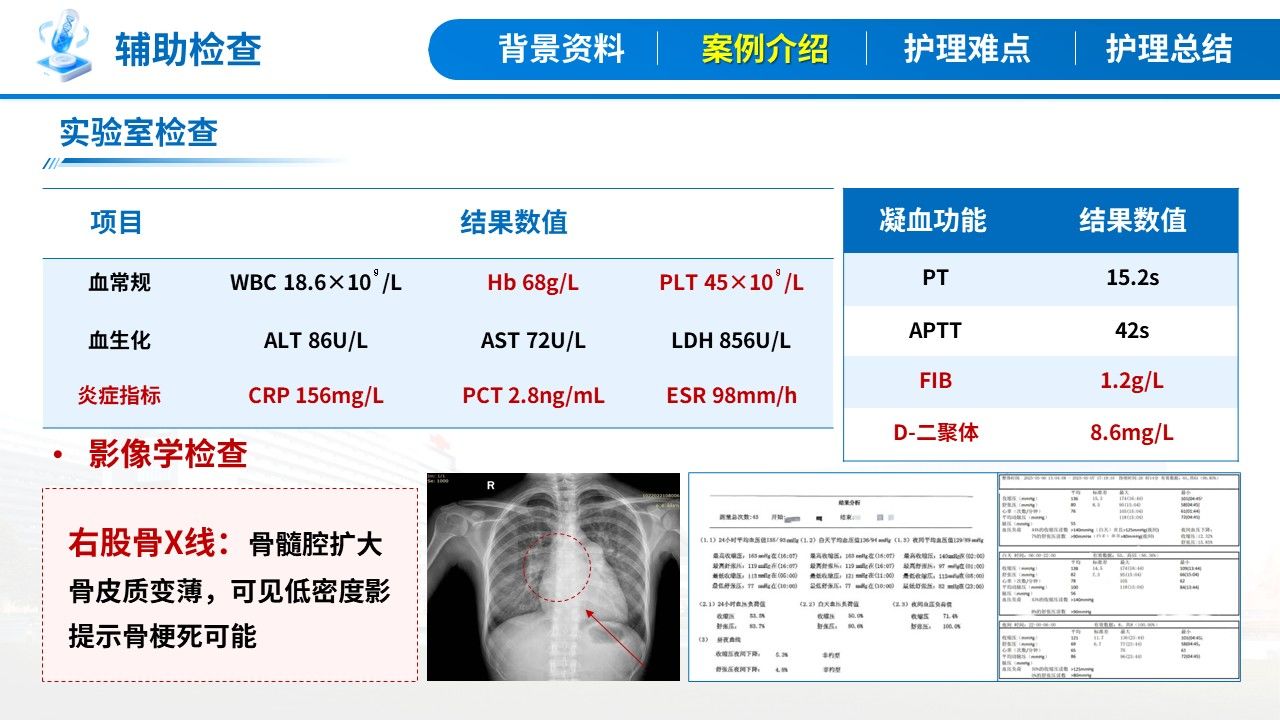 404期-疑难病例讨论-一例戈谢病合并骨危重症患儿的疑难病例讨论第7页预览