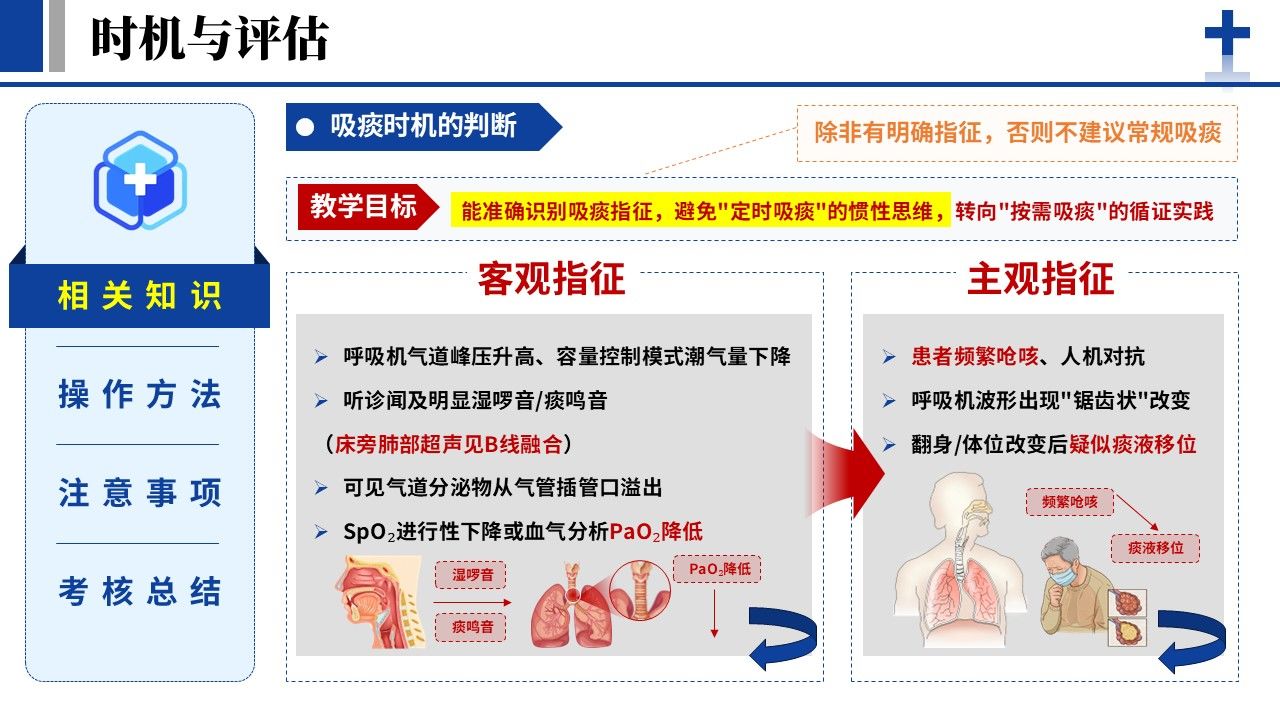 371期-护理说课-人工气道吸痰的标准化操作流程第3页预览
