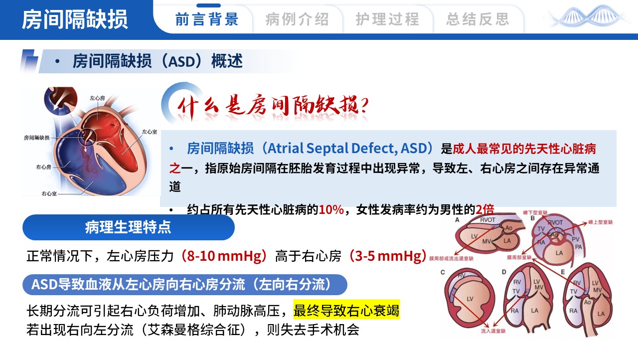 443期-护理个案-一例房间隔缺损介入封堵术患者的护理个案第3页预览