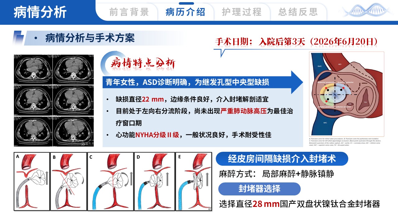 443期-护理个案-一例房间隔缺损介入封堵术患者的护理个案第9页预览