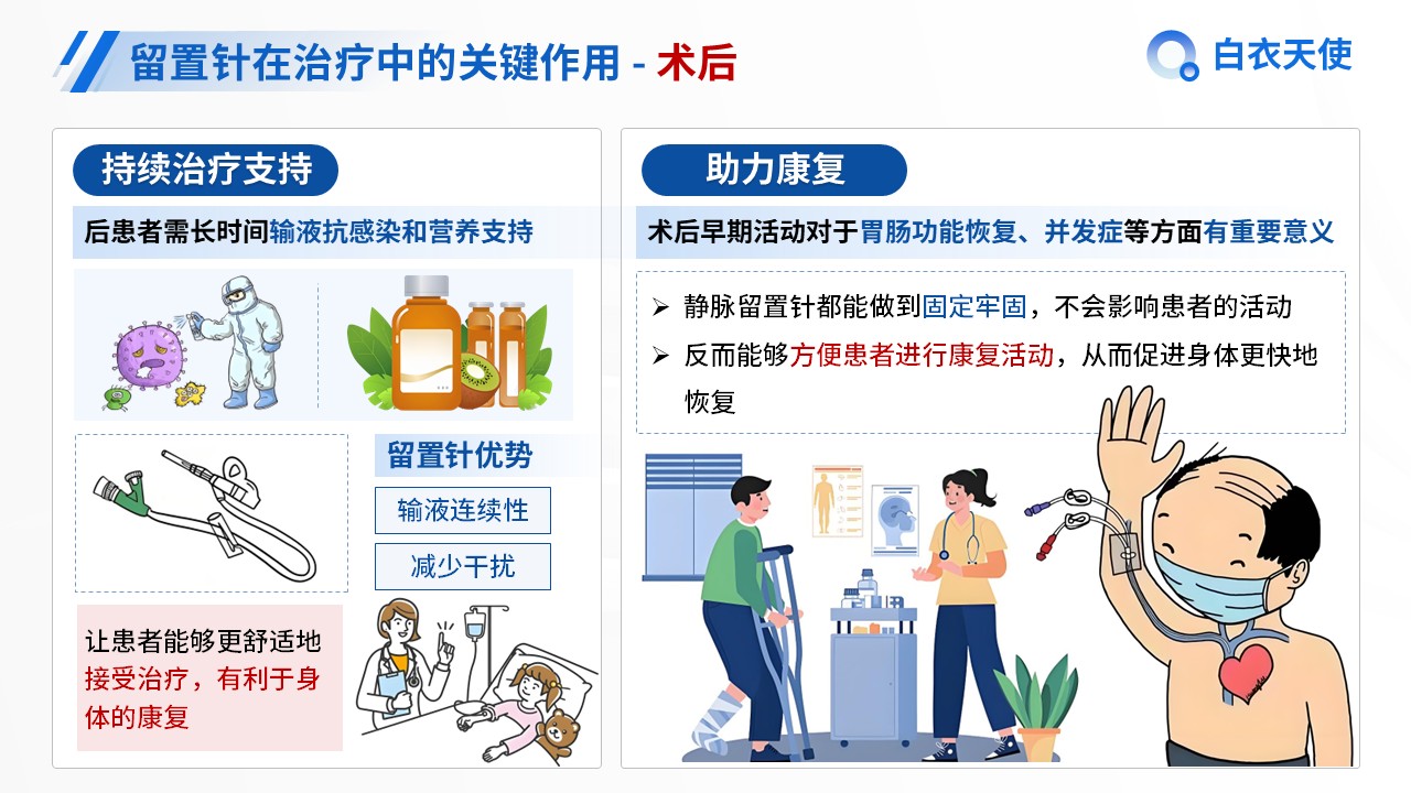 13-静脉留置针健康宣教第8页预览