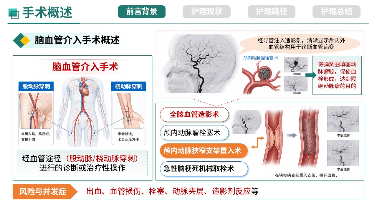 357期-护理质量持续改进-ERAS理念在脑血管介入患者围手术期管理中的应用第4页预览