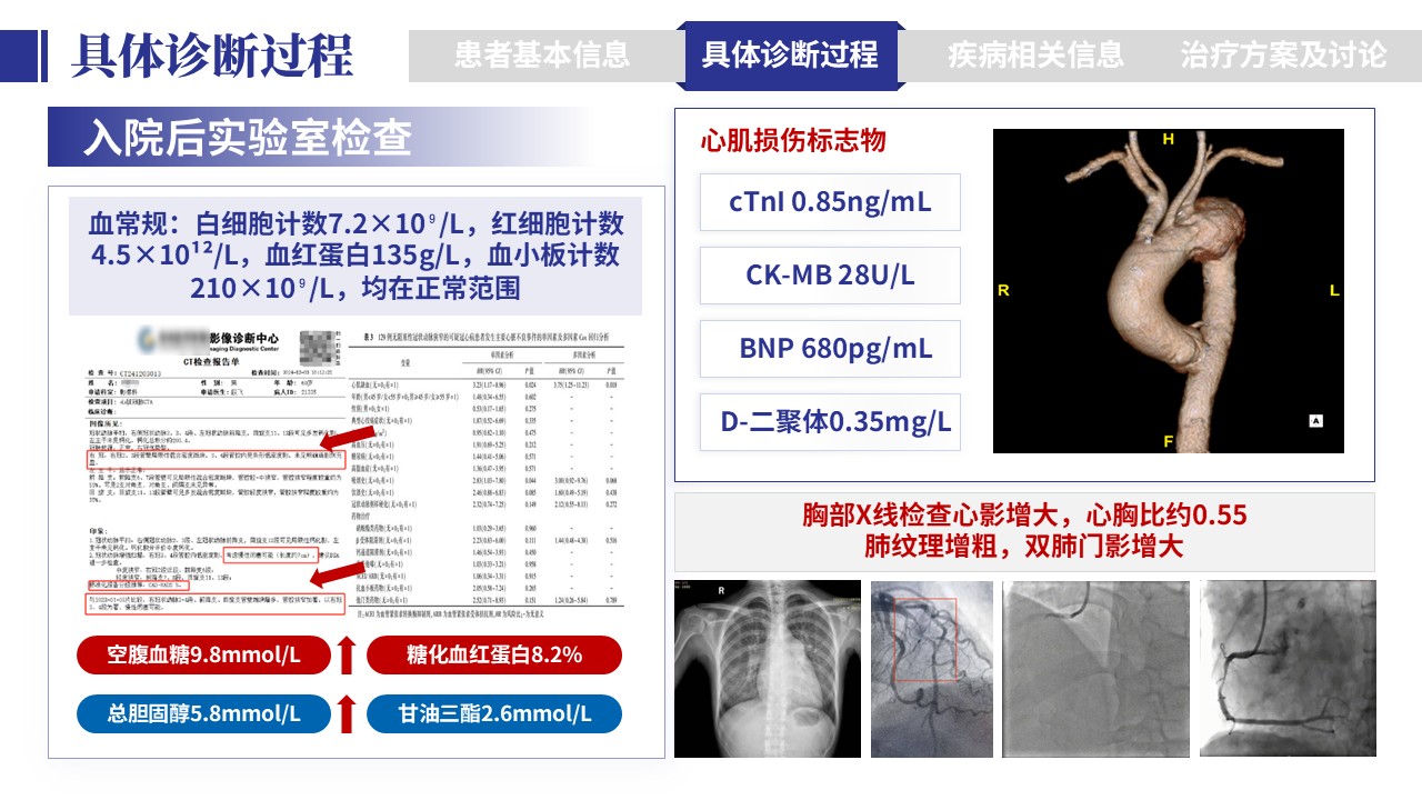 401期-病例汇报-一例多支冠脉病变一站式介入治疗病例汇报第6页预览