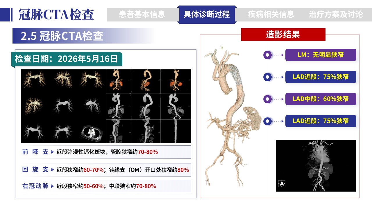 401期-病例汇报-一例多支冠脉病变一站式介入治疗病例汇报第7页预览